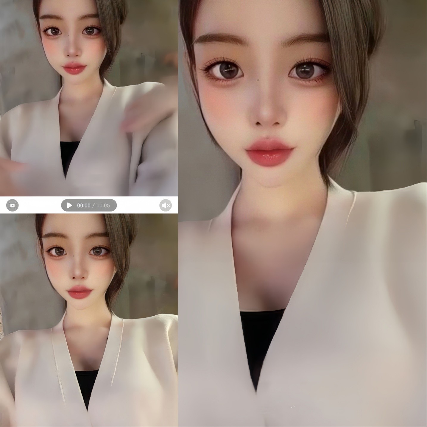 안오면 3대탈모