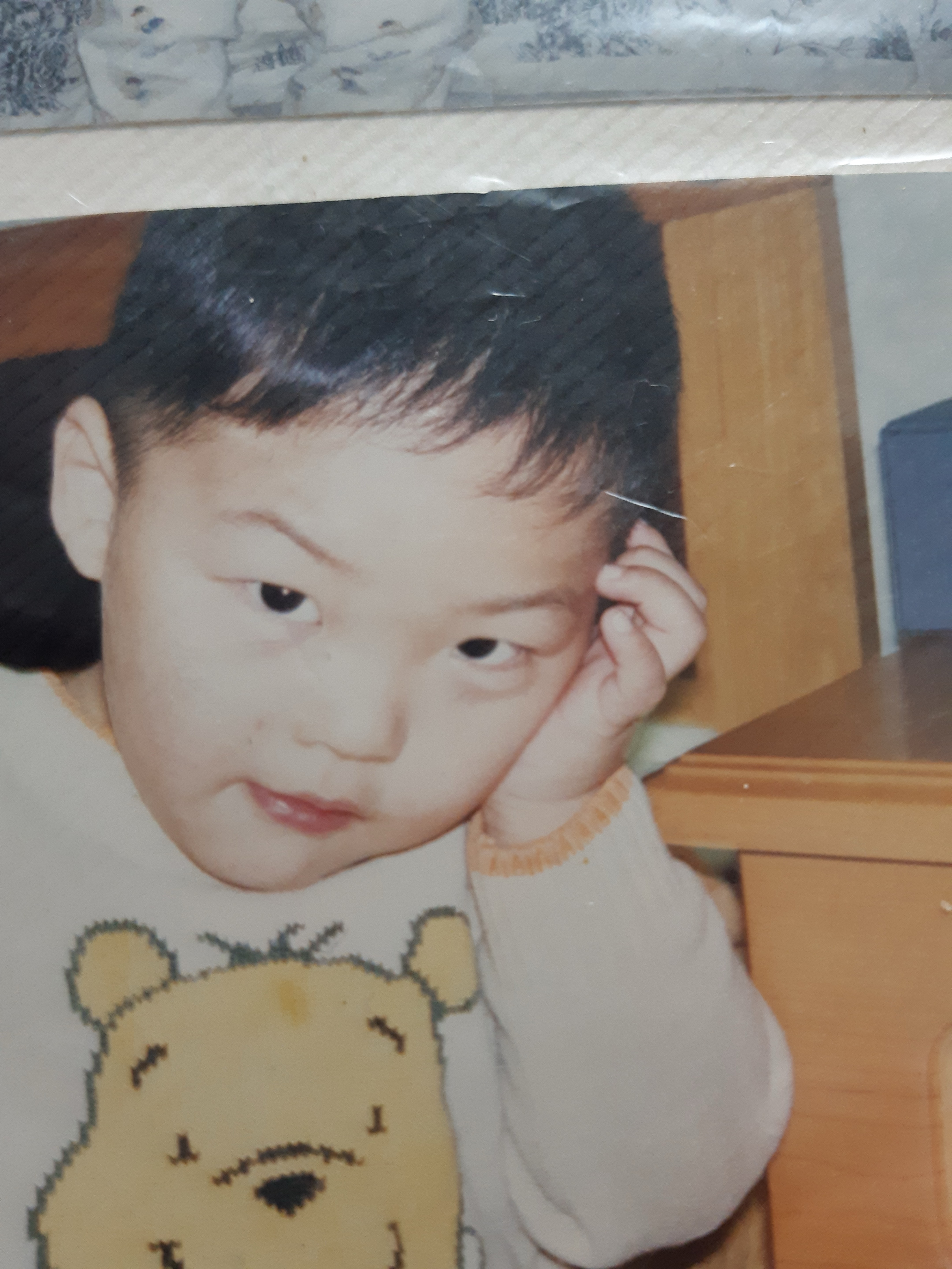 안오면 원형탈모+엠자탈모