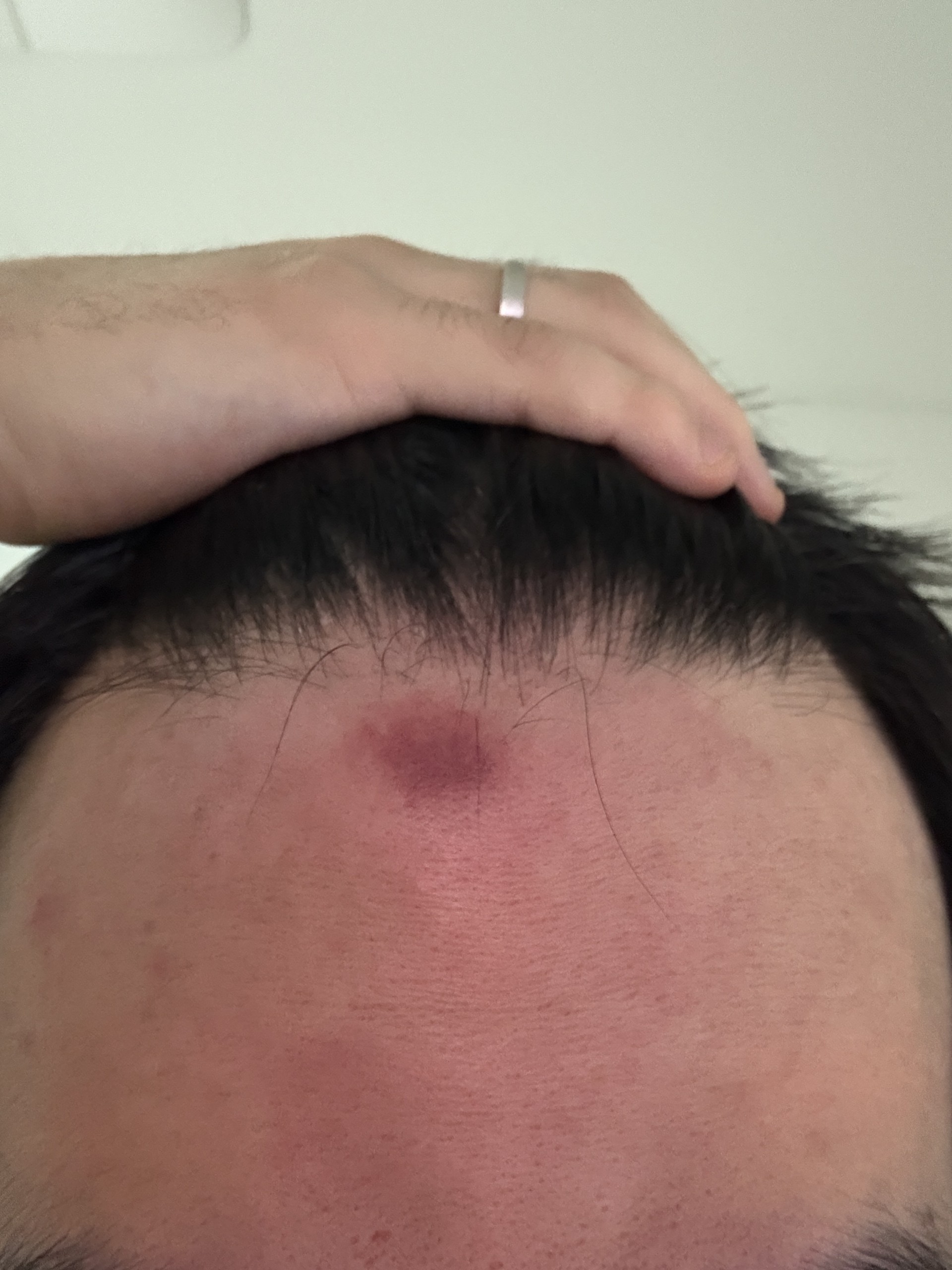 투표좀 부탁하겠습니다.