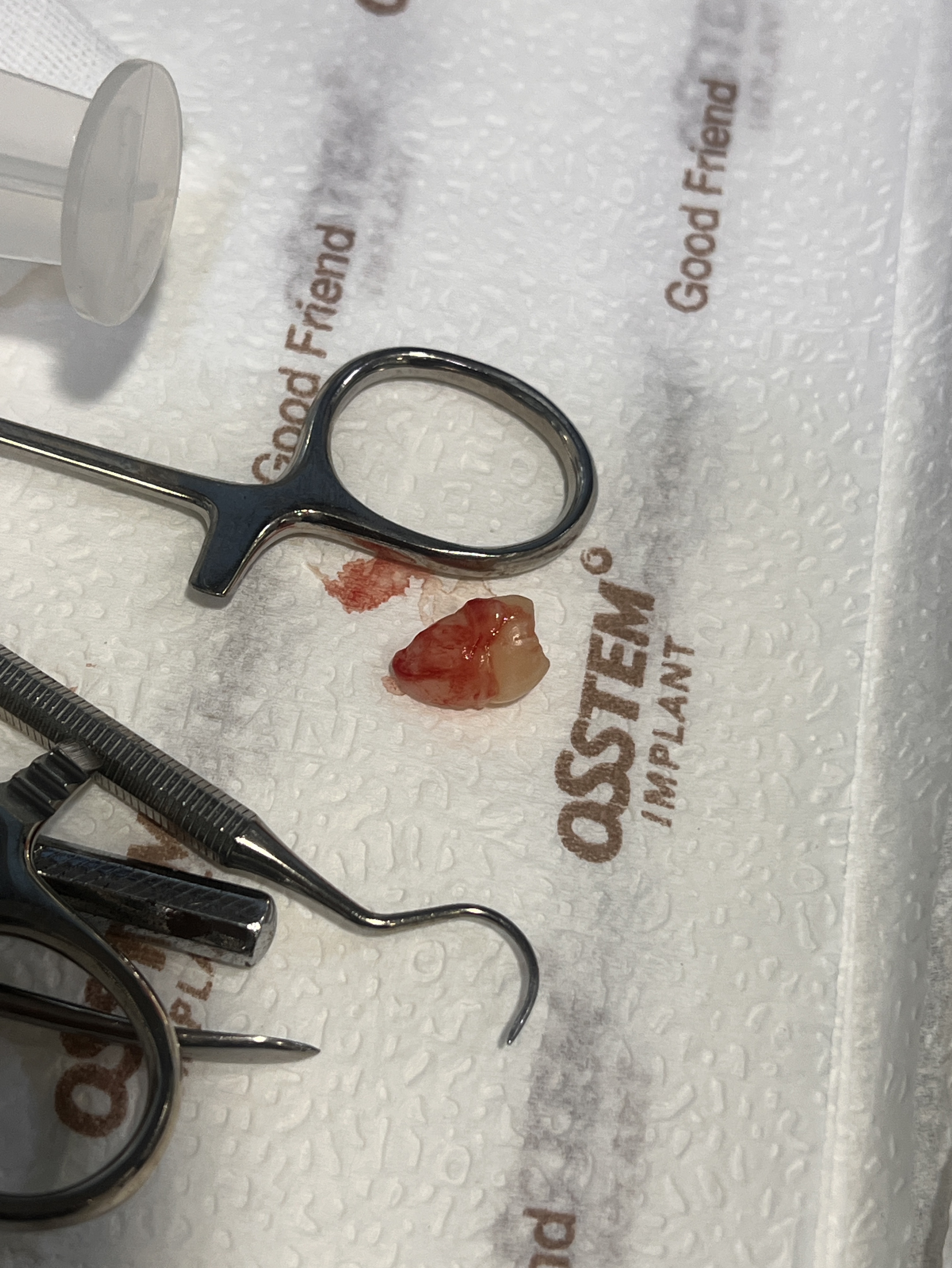 ❄️겨울대비 소개팅❄️ 여자부족🥺