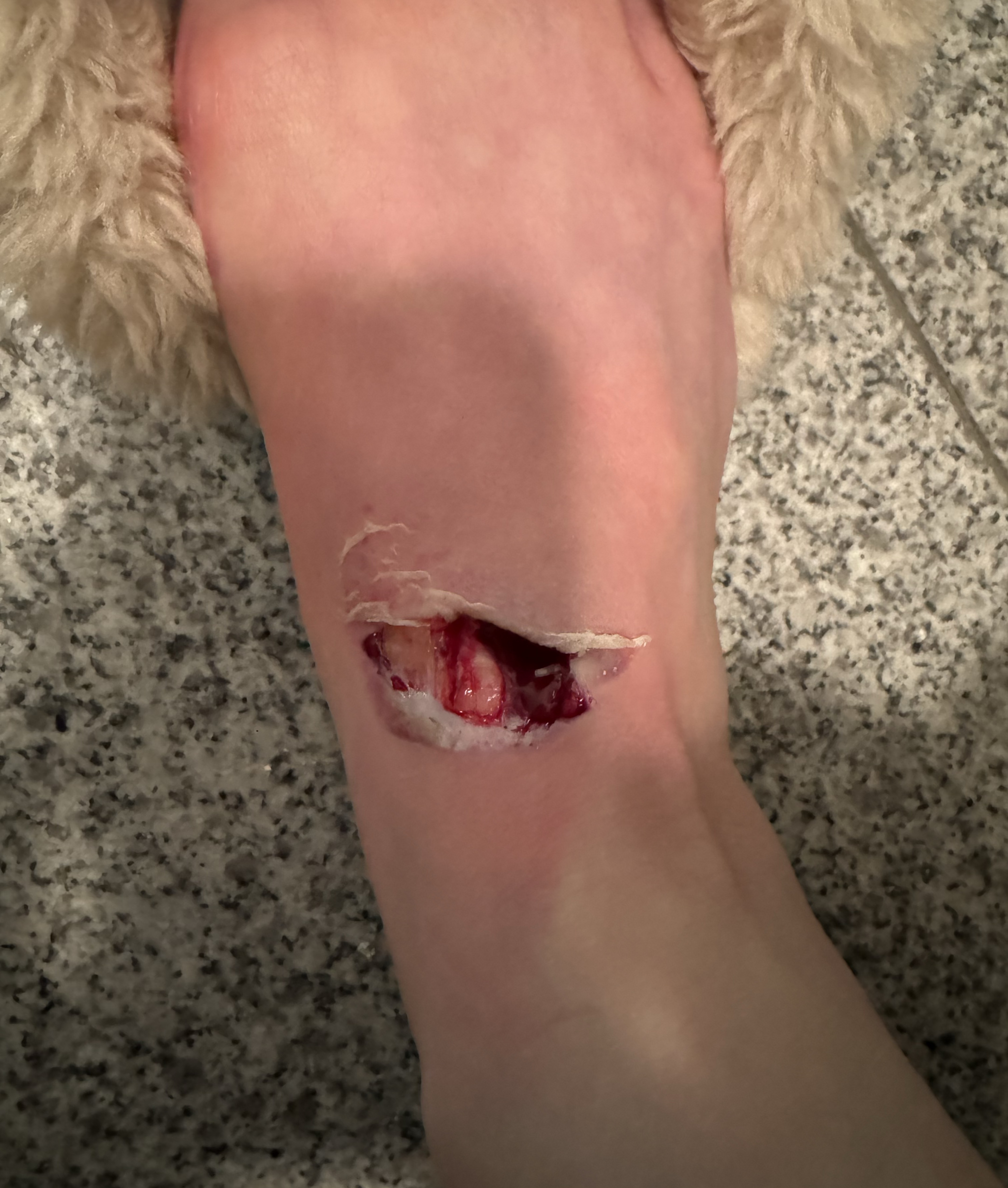 고운이 고운했다고한다