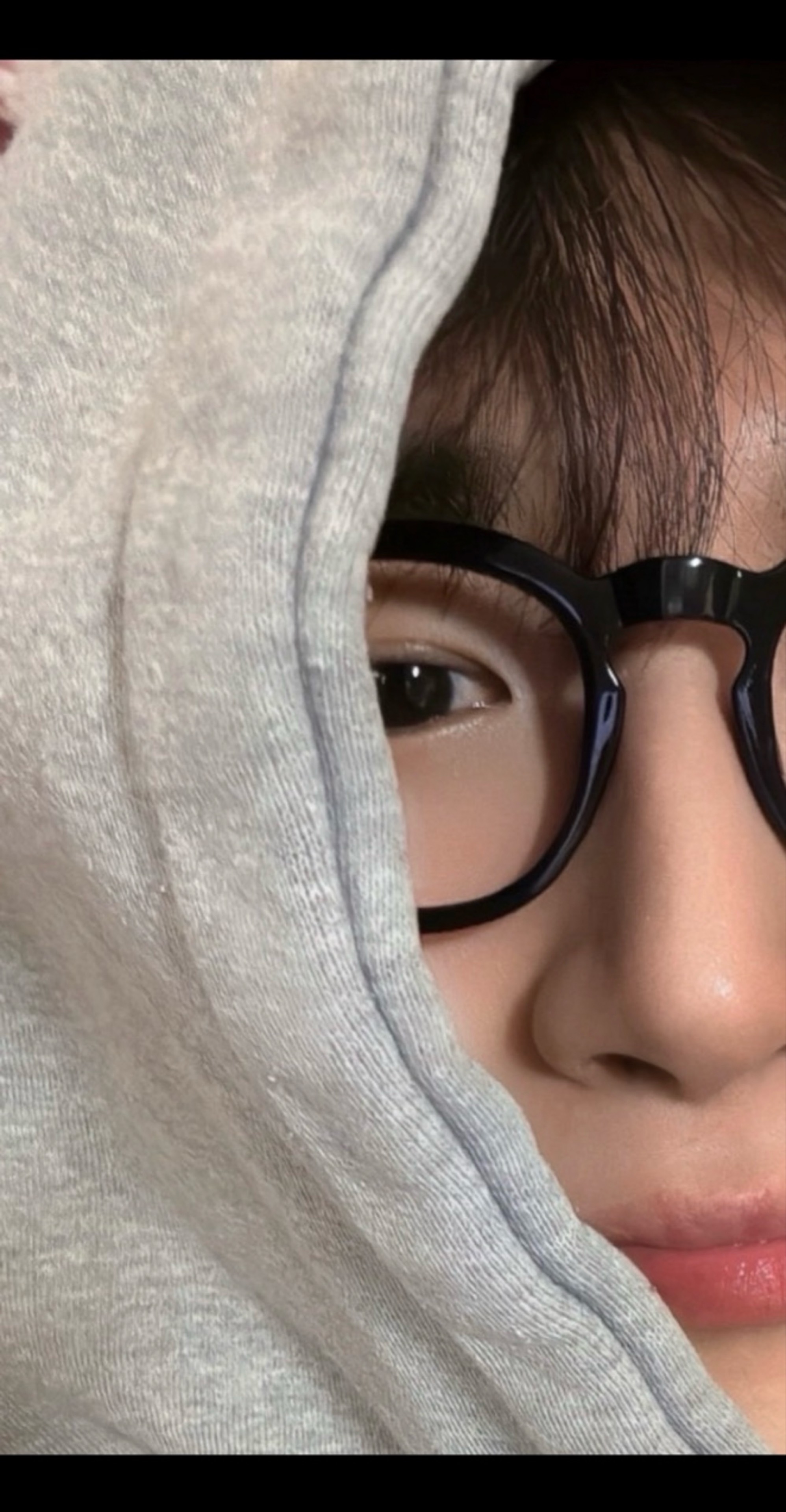 나는 실드 없는 빡빡이 노랑 💛