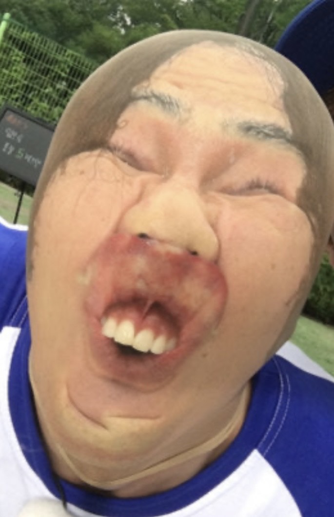 라콜방