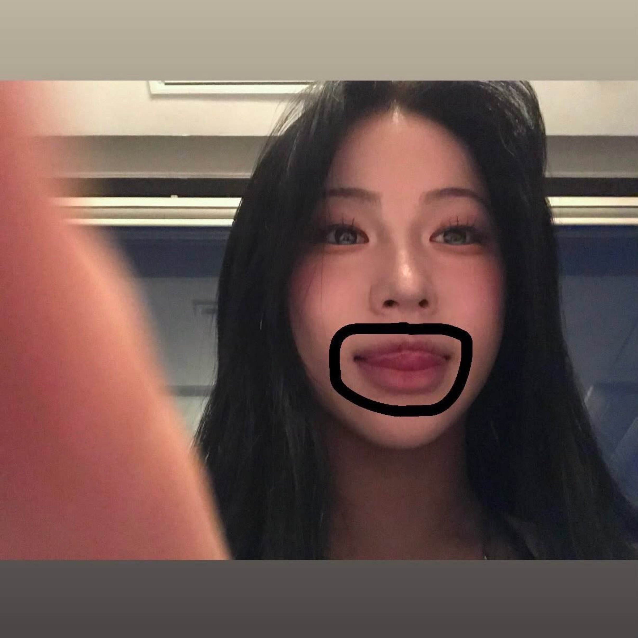 멘헤라정신병
