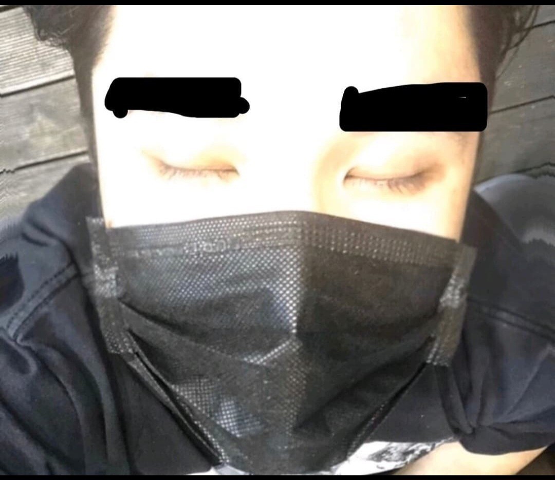 영찌 방송권 [ 🫧 ]