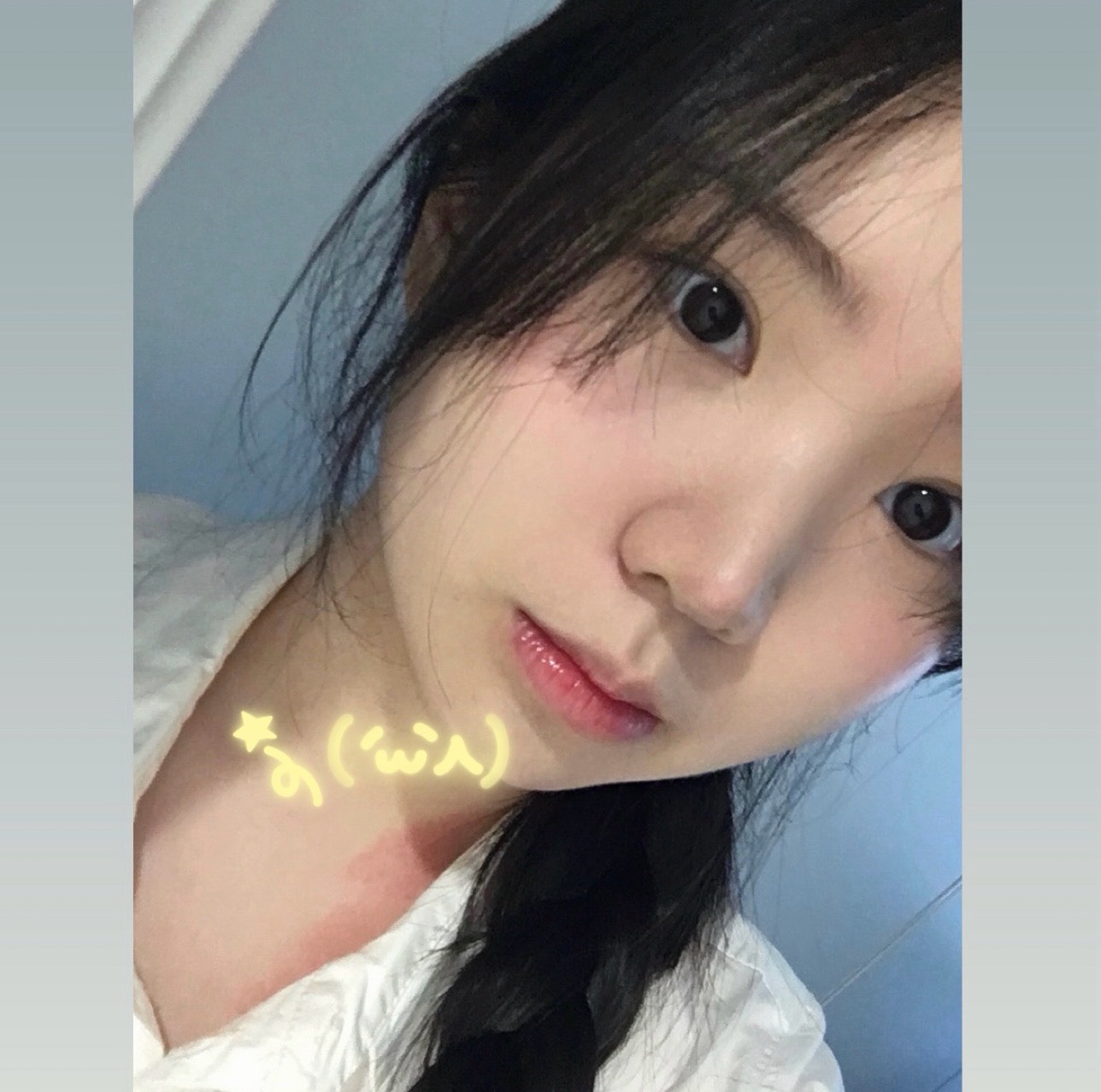 1주년 💛