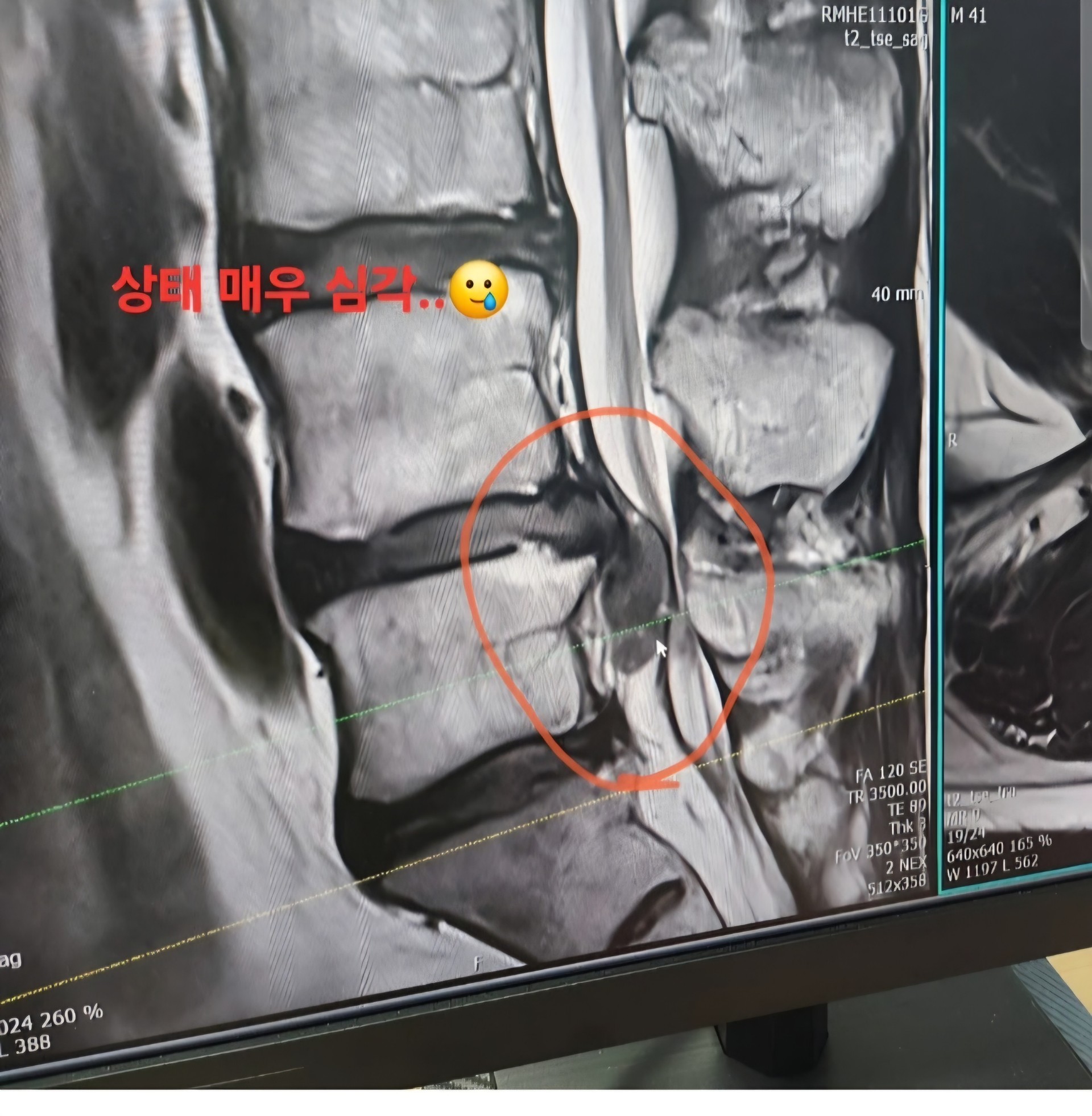 하람 방송권 [ 🫧 ]