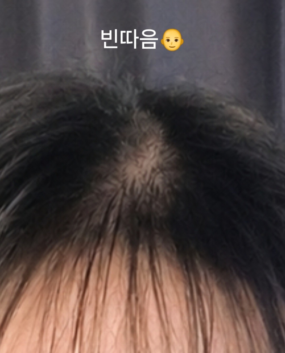 3040+) 노인공격ㄴㄴ 공경좀.👀