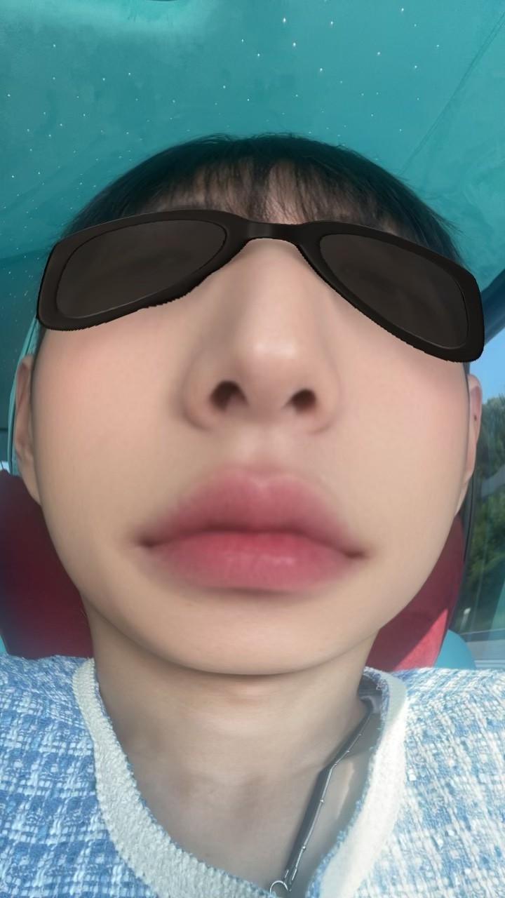 비상비상