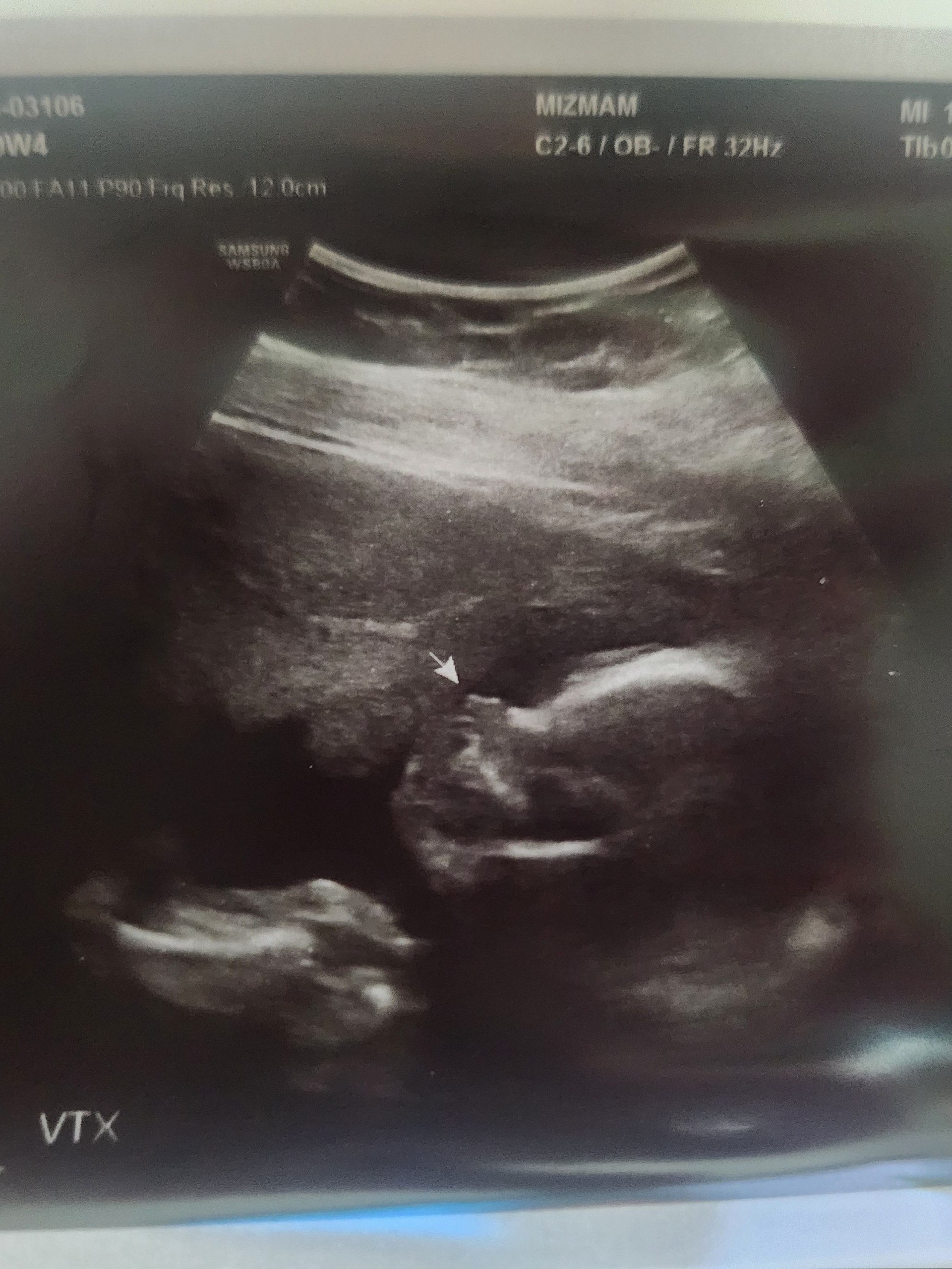 👶 튼튼공쥬님 엄마 비비드  🌸